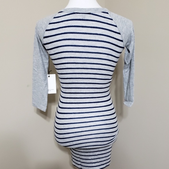 Raglan style striped dress - Picture 4 of 5